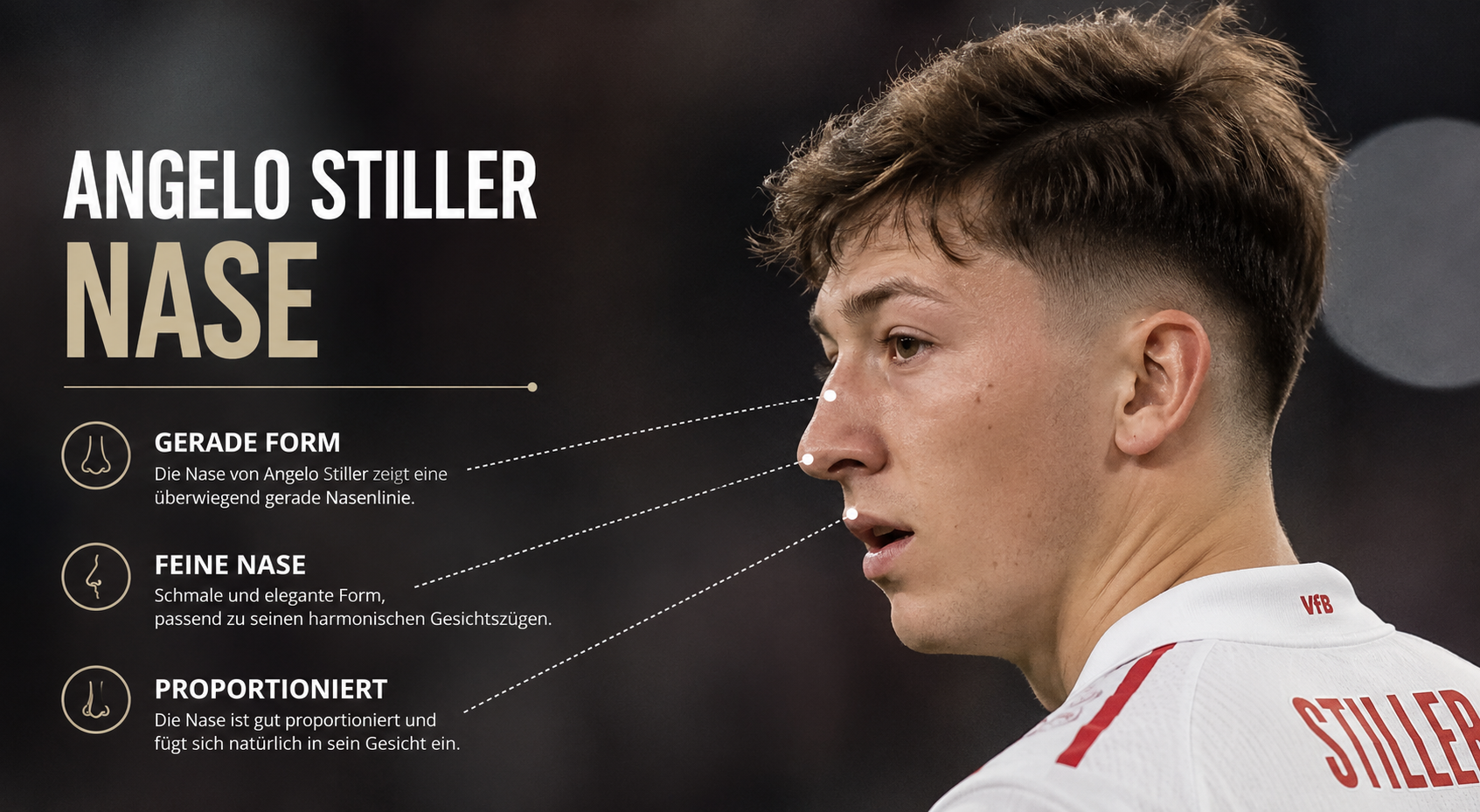 Angelo Stiller Nase